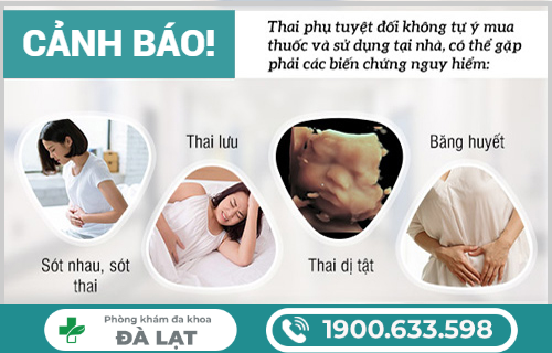 Hình ảnh minh họa